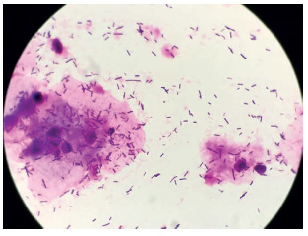 Obraz mikroskopowy bakterii gram-ujemnych
(barwienie Grama)